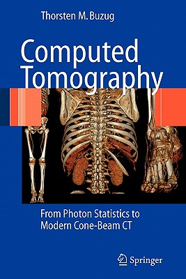 Computed Tomography: From Photon Statistics to Modern Cone-Beam CT-cover