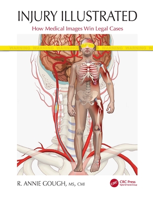 Injury Illustrated: How Medical Images Win Legal Cases-cover