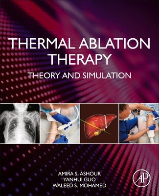 Thermal Ablation Therapy: Theory and Simulation-cover