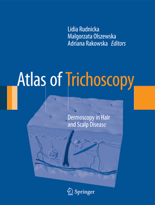 Atlas of Trichoscopy: Dermoscopy in Hair and Scalp Disease-cover