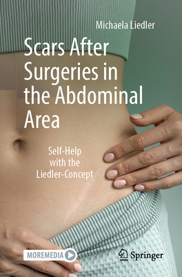 Scars After Surgeries in the Abdominal Area: Self-Help with the Liedler-Concept-cover