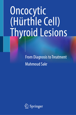Oncocytic (Hürthle Cell) Thyroid Lesions: From Diagnosis to Treatment-cover