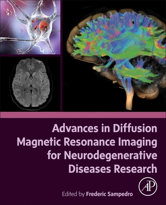 Advances in Diffusion Magnetic Resonance Imaging for Neurodegenerative Diseases Research-cover