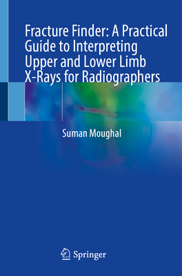 Fracture Finder: A Practical Guide to Interpreting Upper and Lower Limb X-Rays for Radiographers-cover